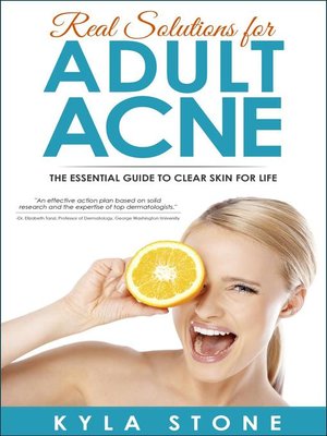cover image of Real Solutions for Adult Acne
